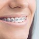 The Role of an Orthodontist in Preventative Dental Care