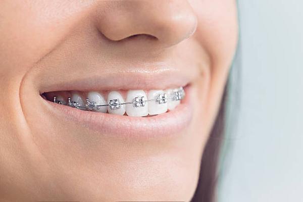 The Role of an Orthodontist in Preventative Dental Care